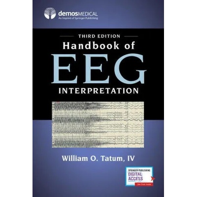 Handbook of EEG Interpretation | Tatum, William O. , IV