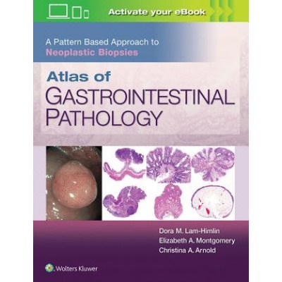 Atlas of Gastrointestinal Pathology: A Pattern Based Approach to Neoplastic Biopsies | Christina Arnold, Dora Lam-Himlin, Elizabeth A. Montgomery