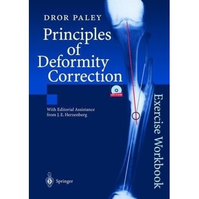 Principles of Deformity Correction Paley Dror