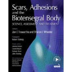 Scars, Adhesions and the Biotensegral Body | Sharon Wheeler (ISBN: 9781912085460)