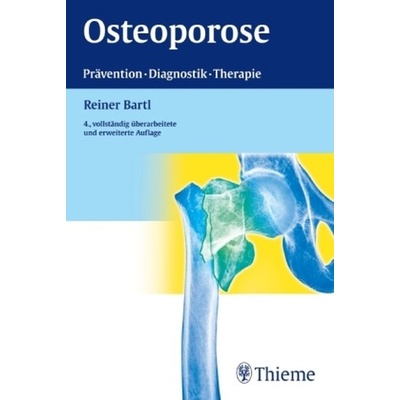 Osteoporose
