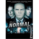 Normal DVD