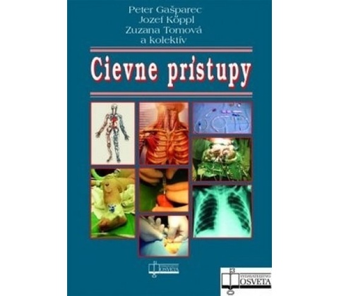 Cievne prístupy