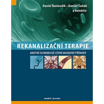 Rekanalizační terapie - Daniel Šeňák, David Školoudík, Kolektiv autorů