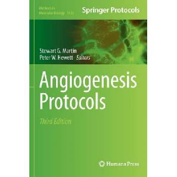 Angiogenesis Protocols | Stewart G. Martin, Peter W. Hewett
