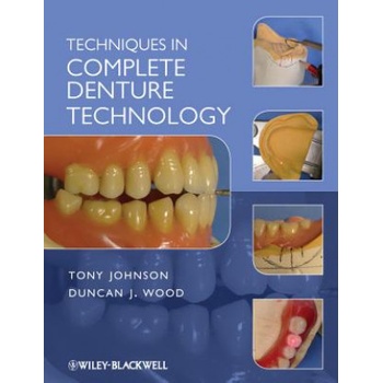Techniques in Complete Denture Technology