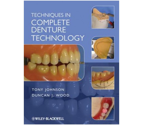 Techniques in Complete Denture Technology