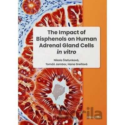The Impact of Bisphenols on Human Adrenal Gland Cells in vitro