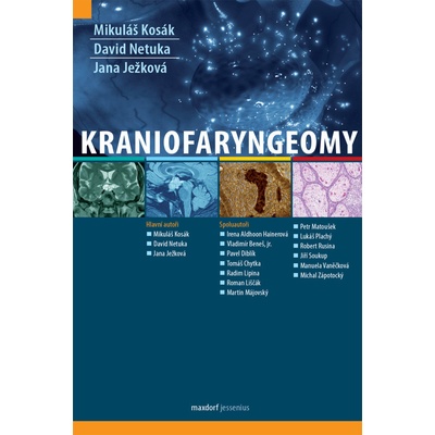 Kraniofaryngeomy - Jana Ježková, Mikuláš Kosák, doc. MUDr. David Netuka Ph.D.