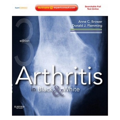 Arthritis in Black and White | Anne C Brower