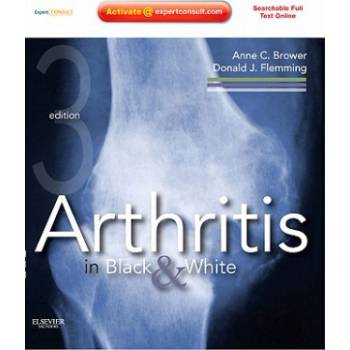 Arthritis in Black and White | Anne C Brower