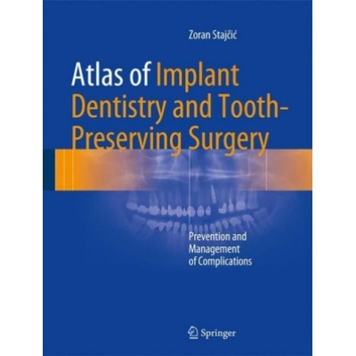 Atlas of Implant Dentistry and Tooth-Preserving Surgery Stajcic Zoran