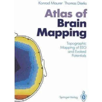 Image 1 of Atlas of Brain Mapping | Konrad Maurer, Thomas Dierks