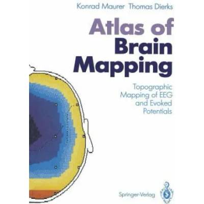 Atlas of Brain Mapping | Konrad Maurer, Thomas Dierks