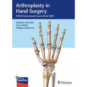 Arthroplasty in Hand Surgery (ISBN: 9783132431744)