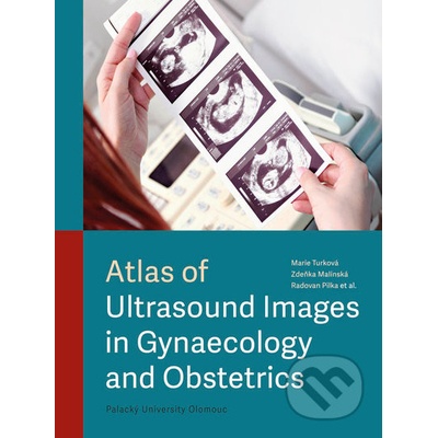 Atlas of Ultrasound Images in Gynaecology and Obstetrics - Marie Turková, Zdeňka Malínská, Radovan Pilka, kolektiv autorů