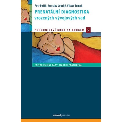 Prenatální diagnostika vrozených vývojových vad - Petr Polák; Jaroslav Loucký; Viktor Tomek