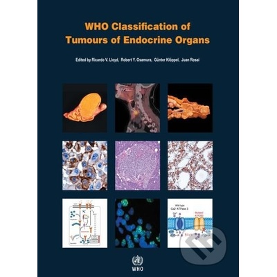 WHO Classification of Tumours of Endocrine Organs