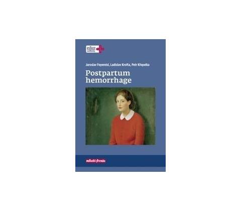 Postpartum hemorrhage
