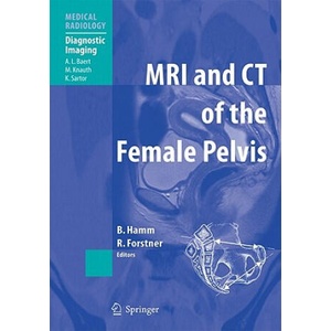 MRI and CT of the Female Pelvis | Bernd Hamm, Rosemarie Forstner (ISBN: 9783642060892)