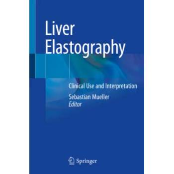 Image 1 of Liver Elastography: Clinical Use and Interpretation | Sebastian Mueller