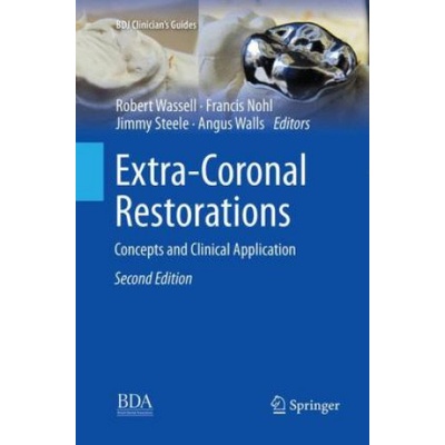 Extra-Coronal Restorations | Robert Wassell, Francis Nohl, Jimmy Steele, Angus Walls