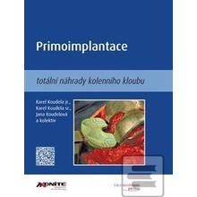 Primoimplantace totální náhrady kolenního kloubu