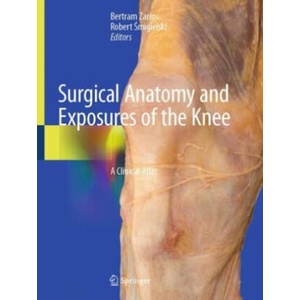 Surgical Anatomy and Exposures of the Knee | Bertram Zarins, Robert Smigielski (ISBN: 9783031476600)