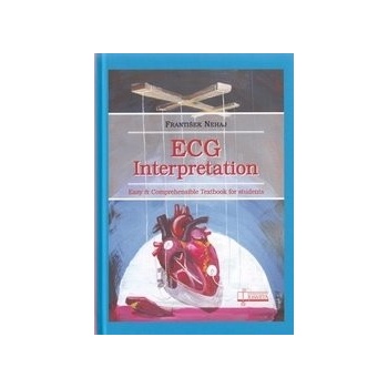 ECG - Interpretation
