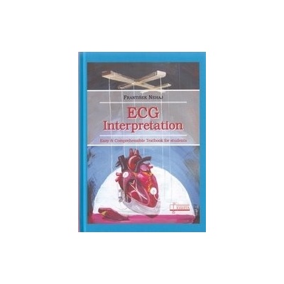 ECG - Interpretation