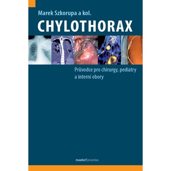 Chylothorax