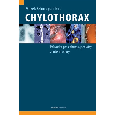 Chylothorax