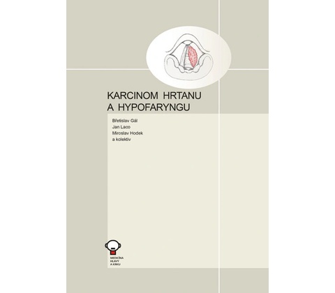 Karcinom rekta