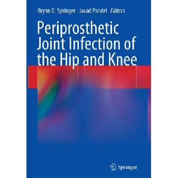 Periprosthetic Joint Infection of the Hip and Knee | Javad Parvizi, Bryan D. Springer