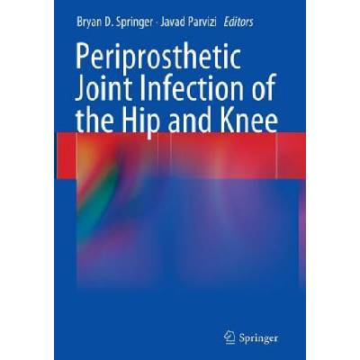 Periprosthetic Joint Infection of the Hip and Knee | Javad Parvizi, Bryan D. Springer