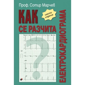 КАК се разчита електрокардиограма (2025)