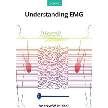 Understanding EMG