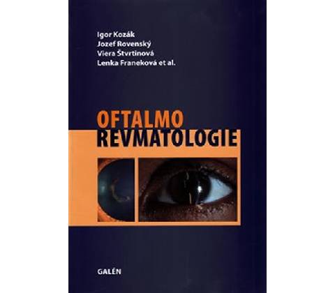 Oftalmorevmatologie