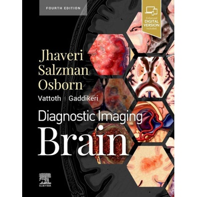 Diagnostic Imaging: Brain - Miral D. Jhaveri