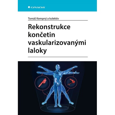 Rekonstrukce končetin vaskularizovanými laloky - Tomáš Kempný
