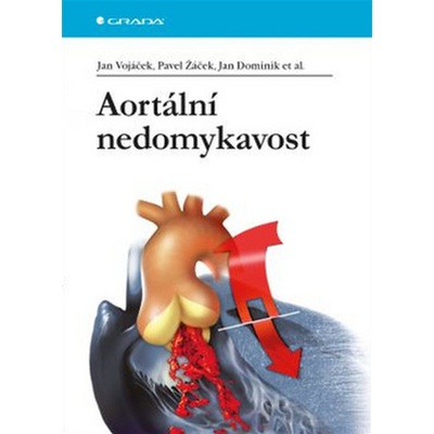 Aortální nedomykavost