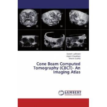 Cone Beam Computed Tomography (CBCT)- An Imaging Atlas | Suresh Ludhwani, Anjani Chaudhary, Bhavin Dudhia