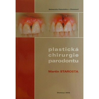 Plastická chirurgie parodontu