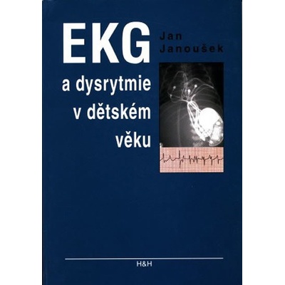 EKG a dysrytmie v dětském věku - Jan Janoušek