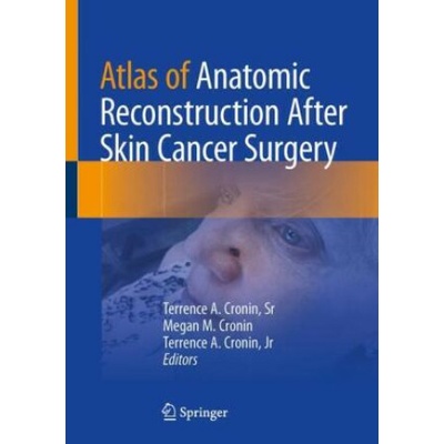 Atlas of Anatomic Reconstruction After Skin Cancer Surgery
