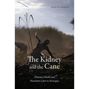 The Kidney and the Cane | Alex M. Nading (ISBN: 9781478031871)