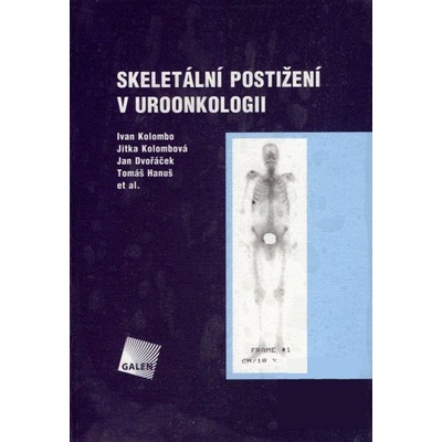 Skeletální postižení v uroonkologii - Ivan Kolombo, Jitka Kolombová, Jan Dvořáček, Tomáš Hanuš