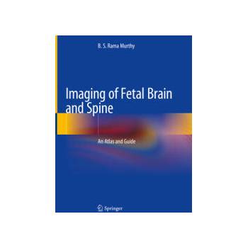 Image 1 of Imaging of Fetal Brain and Spine | B. S. Rama Murthy