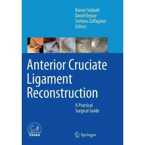 Anterior Cruciate Ligament Reconstruction (ISBN: 9783662510834)