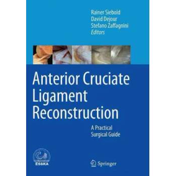 Image 1 of Anterior Cruciate Ligament Reconstruction | Rainer Siebold